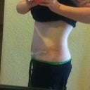 one week post op
