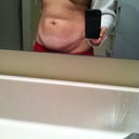 Pre op Pic