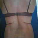 Back [Before] - gives you feel for love handles