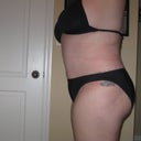 5 week's post-op started smoken again and this is what i get sham on me i know