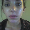 5 days post-op