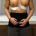 Day after post op