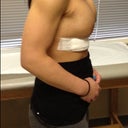 Side view. I'm hunched over because of the discomfort.