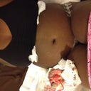 Very swollen belly. But better than before! Day 3 post op