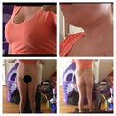 Boobs are 34E (normal size) and starting to flow over the top of bra. I hate this. Chin def needs lipo. This as of now is what I feel makes me look the fattest. Dr P turn this square into a heart !!!