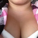Post op perkiness!!!