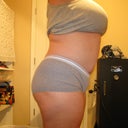 8 month's post pot as you can see my open wound has closed up and healed and in 2 months i get to go in for my SRS woo hoo