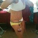 ugh brusing !