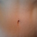 1&1/2 yrs after Tummy Tuck (06/2010)