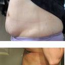 Side view of tummy.
