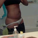 before side view stretch marks extra hanging skin after 5 kids