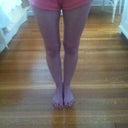 AFTER Zerona: they are smaller for the first time in my 40 years :-) yay!