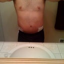 After (4 weeks post-op)