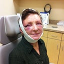 24 hours after surgery.  In doctor's office to have grains removed.