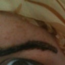 Just under a week after getting the Rejuvi, edges definitely starting to lift. Must. Resist. Temptation. To. Pick! Apparently the longer these ghastly scabs are on my face, the better (more ink it lifts, less chance of scarring etc etc... I just want them gone now!)