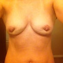 2 months Getting Better :)
