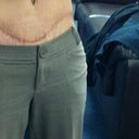 Here is my right side that has a natural "bump" to my body, I get that.