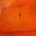Laying down mu stomach gets pretty flat lol 6 weeks po
