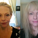 Before and day after