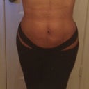 3 MO POST OP