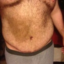 This is about 2 months post op