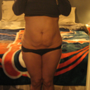 all those stretch marks hopefully will be gone or really low hopefully