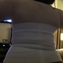 8 day PostOp of Brachioplasty & back folds removed on May 17, 2012