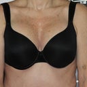 11 days. Wearing a bra