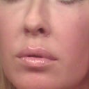 This is me in "good" lighting; you can still see the bluish tint under both eyes.