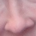 This is several weeks after getting restalyn and 3 injections to dissolve. My left eye is a nightmare.