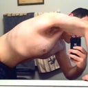 27 days post-op... leaning over to compare belly hang.