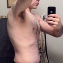 27 days post-op... side view.