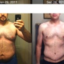 27 days post-op. Comparison to start of 2011.