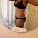 6 months post- op scar