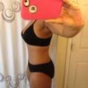 6 months post- op side view