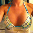 1 Day Post-Op.. Unpadded bikini
