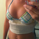 1 Day Post-Op.. Unpadded bikini