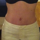 Almost 6 weeks PO. Feeling and looking sexy!