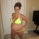 Heres a picture of me pregnant last summer so you can see my strech marks which actually look better here than not pregnant because they are streched out. I will post more picture after surgery. Before and after.
