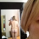 Back - 5 days post op.