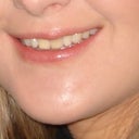 Before smiling