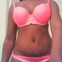 2 mos. scar pic