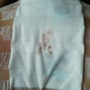 A little bloody a few hours after treatment.