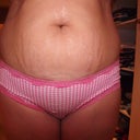 Will be glad to see the back of these stretch marks :)