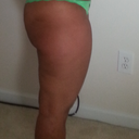 side view