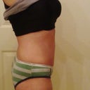 Rt Side..you can see my arm scars in both side pics..not too pretty but getting better