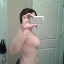 1 month post op