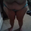 1 day before surgery.