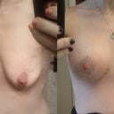 Before/after 4 weeks