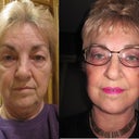 My photos, before and after, at the 8 week mark.